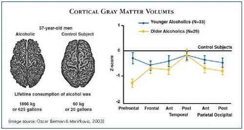 Chart of Cortical Gray Matter Volumes as Affected by Alcohol Use
